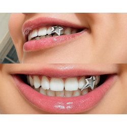 Altın Yıldız Çerçeve Grillz Z311