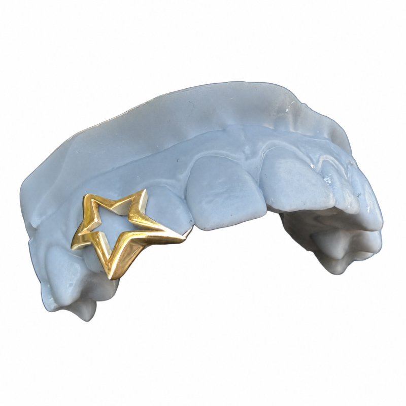 Gold Star Frame Grillz Z311