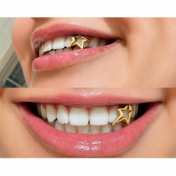 Yıldız Çerçeve Grillz Z305