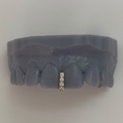 Grillz with Swarovski Z321