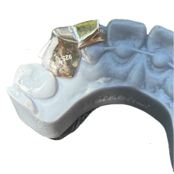 Yıldız Çerçeve Grillz Z305